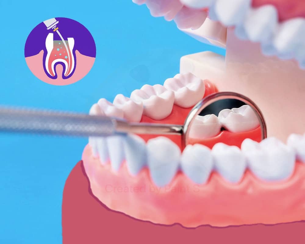 imagen de endodoncia clinica dental moratalaz 66