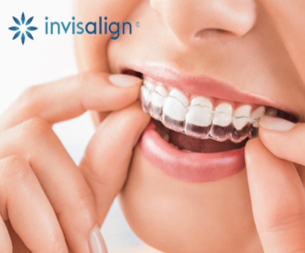 Imagen de Tratamiento Invisalign Clinica Dental Madrid